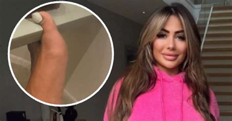 Chloe Ferry calls fire brigade naked after getting foot .